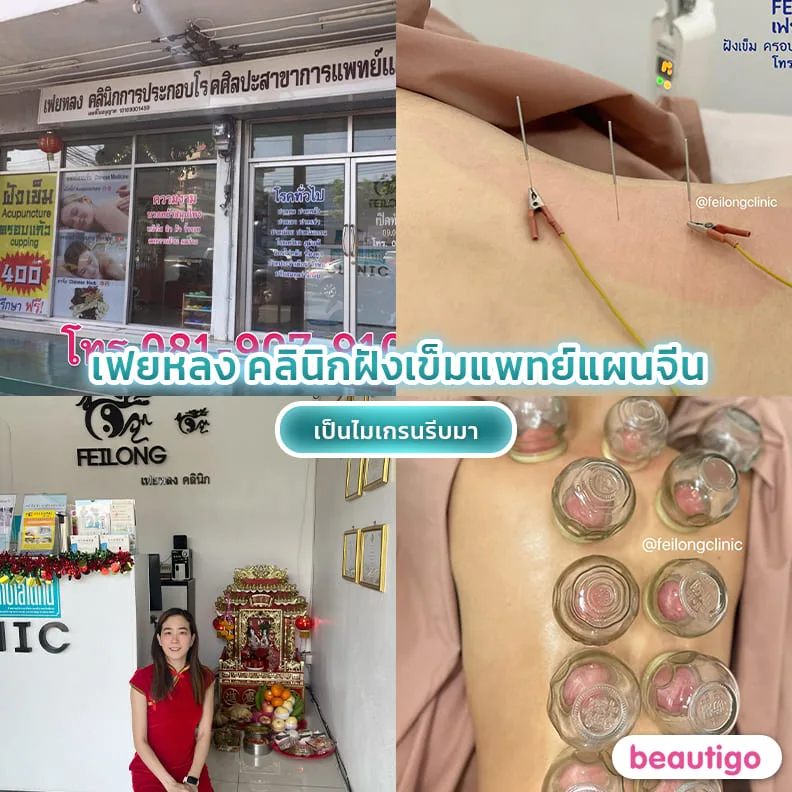 คลินิกฝังเข็มแพทย์แผนจีนเฟยหลง 