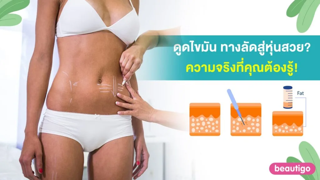 ดูดไขมัน ทางลัดสู่หุ่นสวย? ความจริงที่คุณต้องรู้!